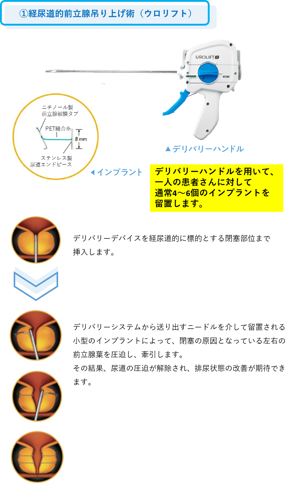 87be5bd92f49adf8781108fe2fcd2b84-1790250125.png