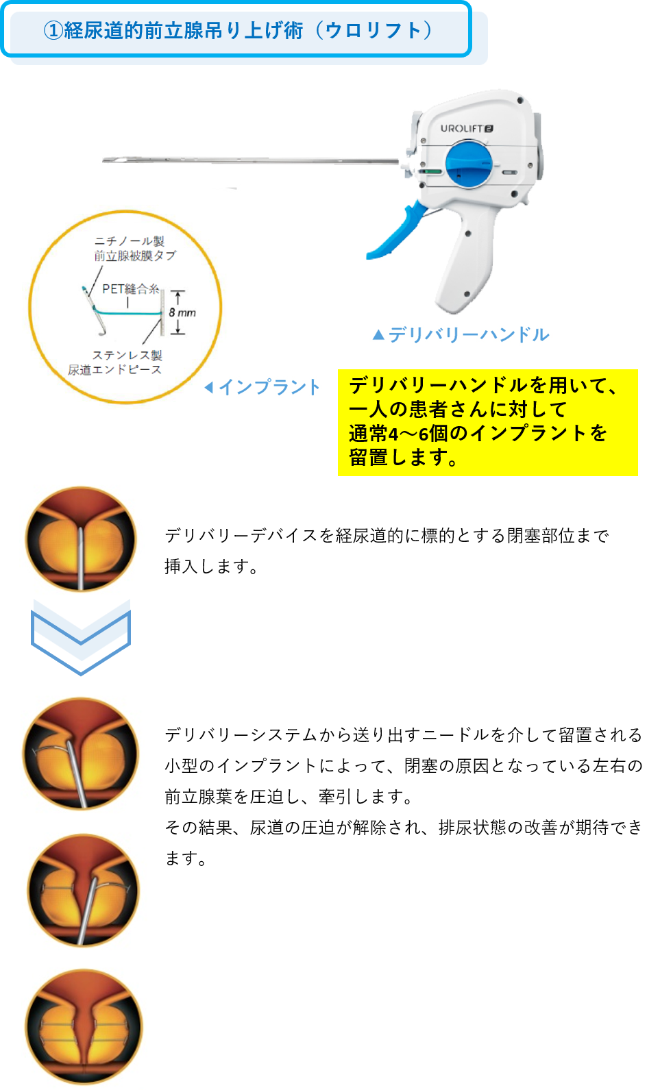 20250501_2.png