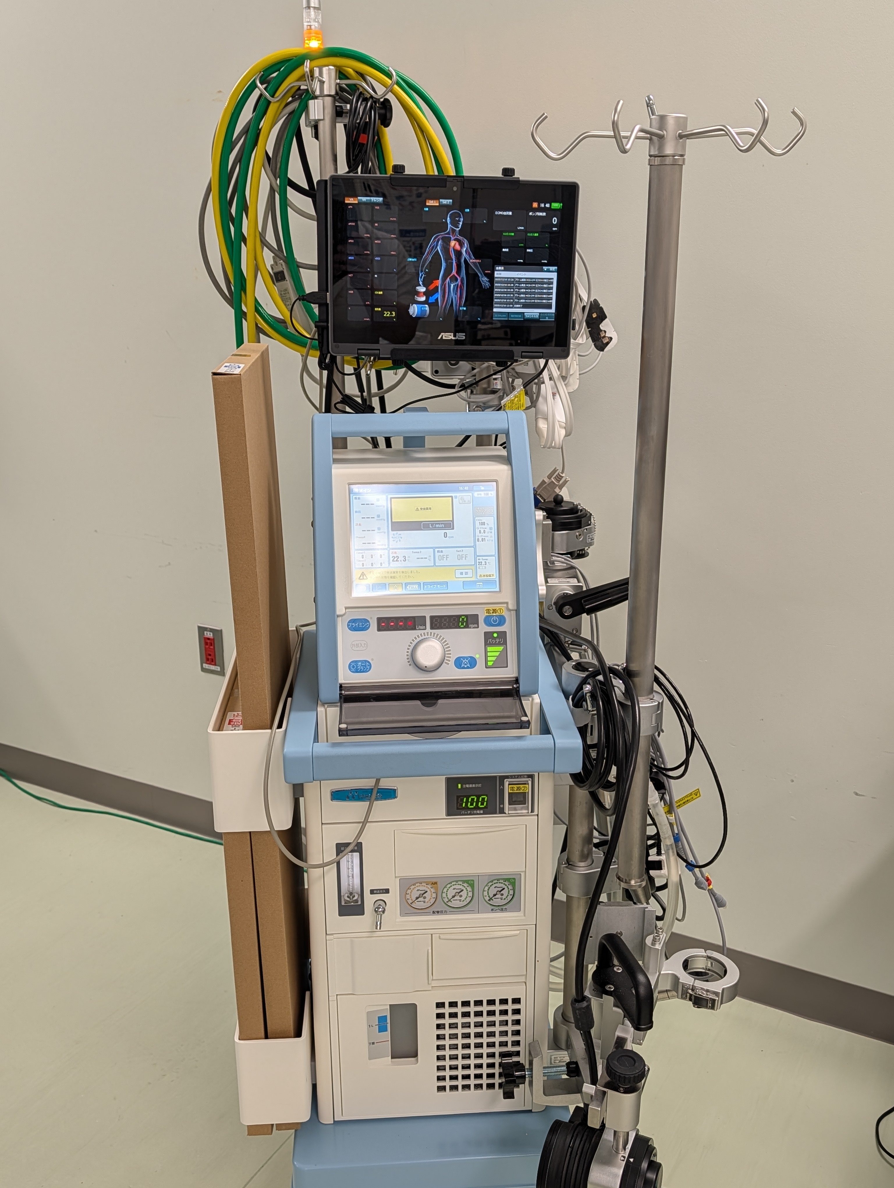 経皮的心肺補助装置（ECMO）